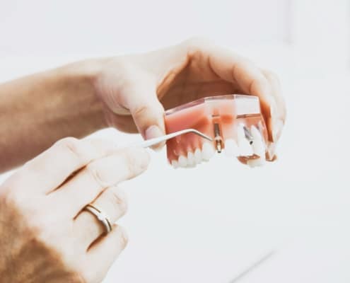 Dental implants preferred option for missing teeth Tampa