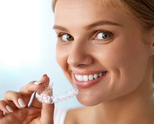 Invisalign Clear Aligners Tampa