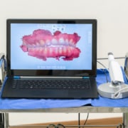 TMJ Symptoms and Treatment Explained