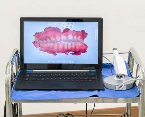 TMJ Symptoms and Treatment Explained